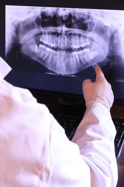 Best Emergency Dentist for Knocked-Out Tooth in Eagle Point, OR