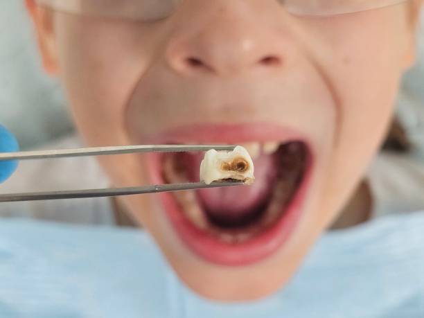 Best Pediatric Emergency Dentist in Eagle Point, OR